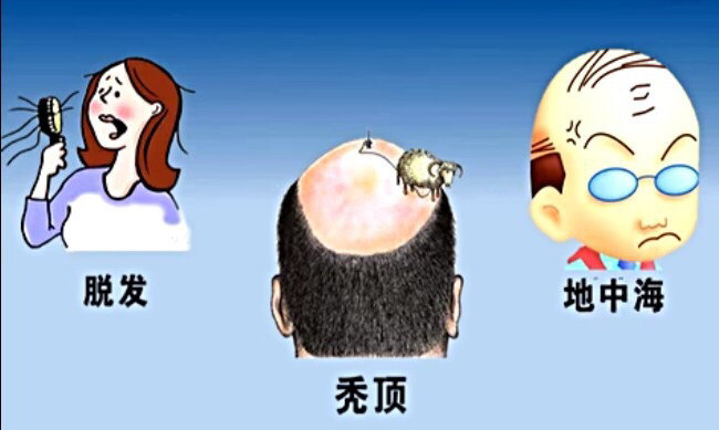 脱发的罪魁祸首有哪些