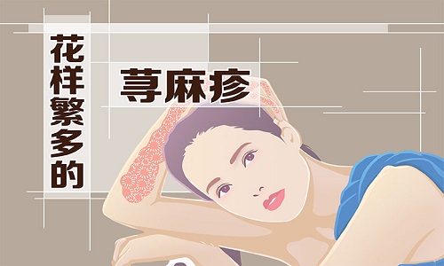 荨麻疹的种类