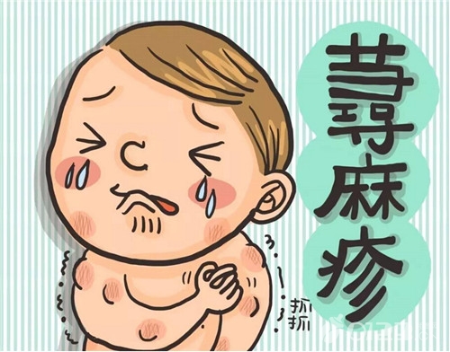 小儿荨麻疹的发病原因