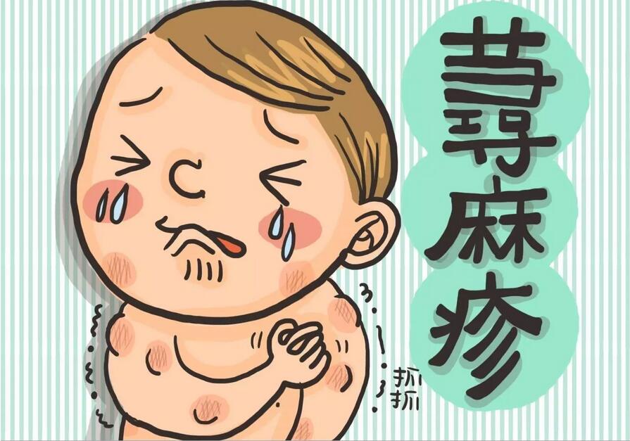 小儿荨麻疹怎么治疗效果较好