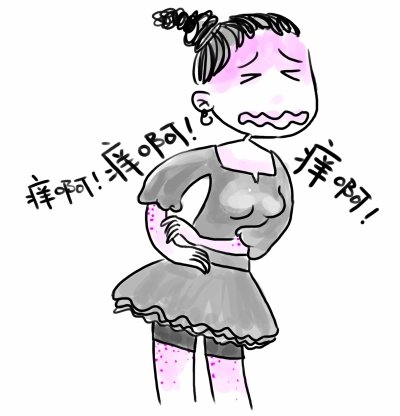 过敏性皮炎传染吗