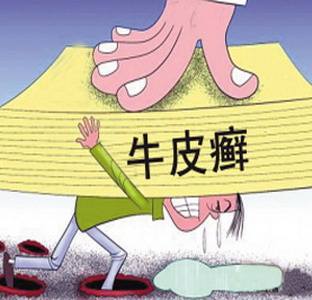 牛皮癣发作与哪些因素有关系?