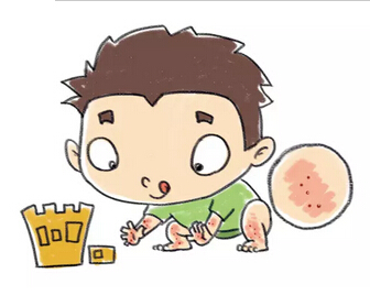 荨麻疹会传染吗?