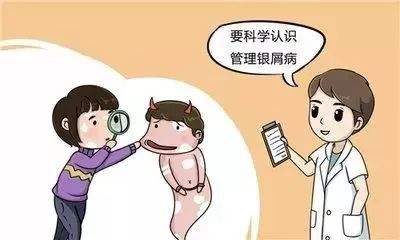 关节型牛皮癣的常见症状有哪些