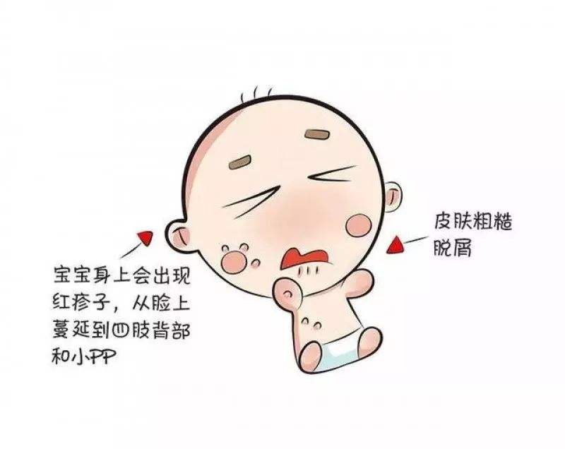 预防湿疹要吃哪些蔬菜