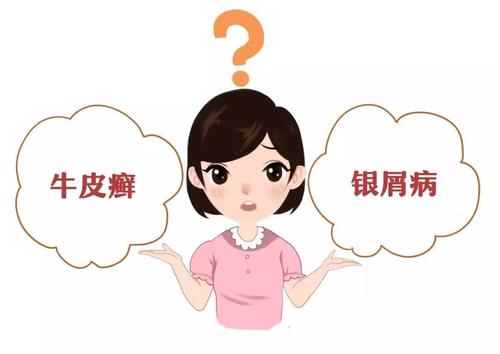 牛皮癣患者如何缓解症状
