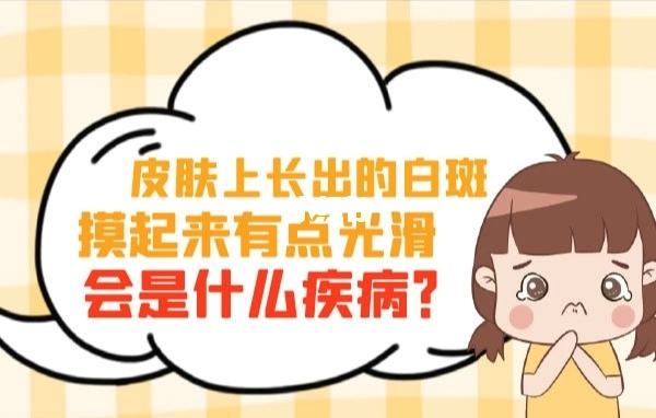 手上长了白癜风该注意什么