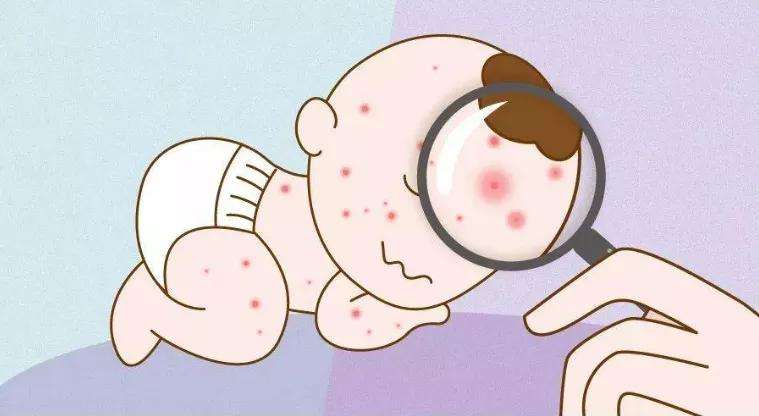 苏州治疗皮炎医院哪个好