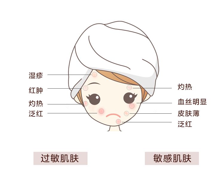 苏州皮肤过敏去哪里看好
