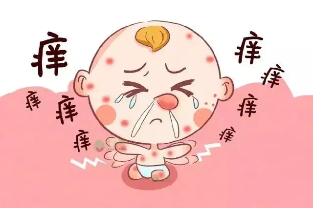 脸上过敏发红怎么快速消除